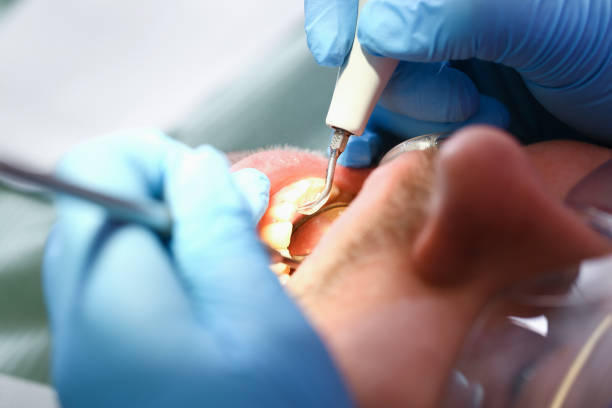 Best Emergency Care for Gum Disease in Cadiz, OH